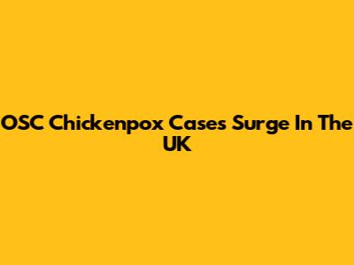 OSC Chickenpox Cases Surge In The UK