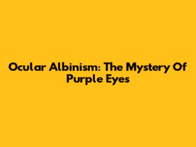 Ocular Albinism: The Mystery Of Purple Eyes
