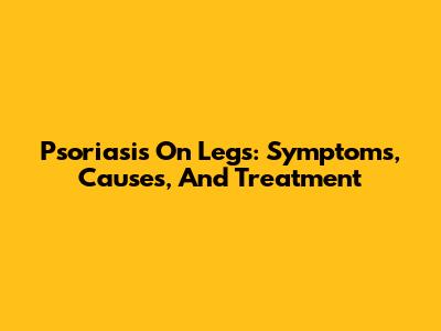 Psoriasis On Legs: Symptoms, Causes, And Treatment